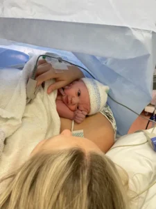 Chester elective c section at DVH gestational diabetes