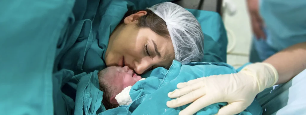 Hypnobirthing for a c section